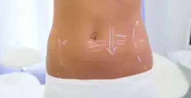 Lipoláser y Presoterapia