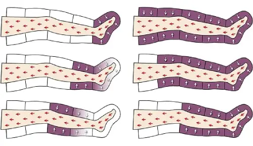Lipolaser y Presoterapia 03